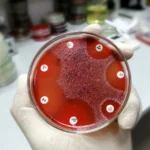محیط کشت Blood Agar