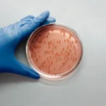 محیط کشت MacConkey Agar