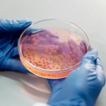 محیط کشت Nutrient Agar